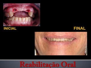 INICIALFINALReabilitação Oral