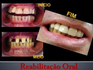 INÍCIOFIMMEIOReabilitação Oral