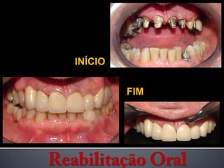 INÍCIOFIMReabilitação Oral