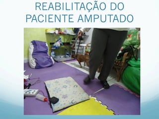 REABILITAÇÃO DO
PACIENTE AMPUTADO
 