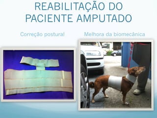 REABILITAÇÃO DO
 PACIENTE AMPUTADO
Correção postural   Melhora da biomecânica
 