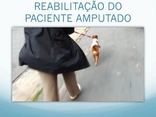 REABILITAÇÃO DO
PACIENTE AMPUTADO
 