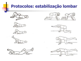 Protocolos: estabilização lombar
 