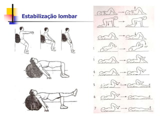 Estabilização lombar
 