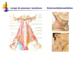 Longo do pescoço/ escalenos Esternocleidomastóideo
 