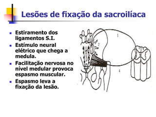 Lesões de fixação da sacroilíaca
 Estiramento dos
ligamentos S.I.
 Estímulo neural
elétrico que chega a
medula.
 Facilitação nervosa no
nível medular provoca
espasmo muscular.
 Espasmo leva a
fixação da lesão.
 