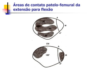 Áreas de contato patelo-femural da
extensão para flexão
 
