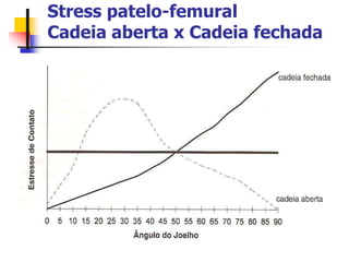 Stress patelo-femural
Cadeia aberta x Cadeia fechada
 
