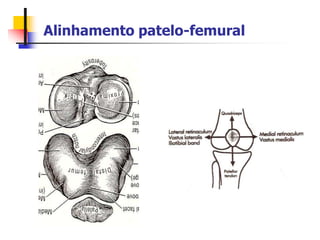 Alinhamento patelo-femural
 