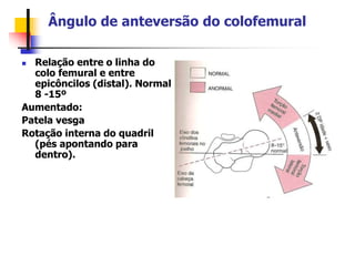 Ângulo de anteversão do colofemural
 Relação entre o linha do
colo femural e entre
epicôncilos (distal). Normal
8 -15º
Aumentado:
Patela vesga
Rotação interna do quadril
(pés apontando para
dentro).
 