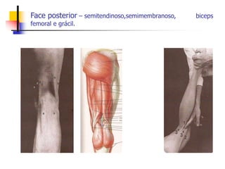 Face posterior – semitendinoso,semimembranoso, biceps
femoral e grácil.
 
