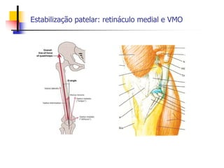 Estabilização patelar: retináculo medial e VMO
 