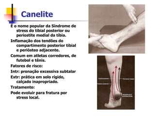 Canelite
É o nome popular da Síndrome de
stress do tibial posterior ou
periostite medial da tíbia.
Inflamação dos tendões do
compartimento posterior tibial
e periósteo adjacente.
Comum em atletas corredores, de
futebol e tênis.
Fatores de risco:
Intr: pronação excessiva subtalar
Extr: prática em solo rígido,
calçado inapropriado.
Tratamento:
Pode evoluir para fratura por
stress local.
 