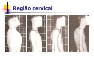 Região cervical
 