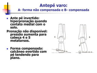 Antepé varo:
A- forma não compensada e B- compensada
 Ante pé invertido:
hiperpronação quando
contato medial com o
solo.
Pronação não disponível:
pressão aumenta para
cabeça 4 e 5
metatarsos.
 Forma compensada:
calcâneo evertido com
pé tendendo para
plano.
 