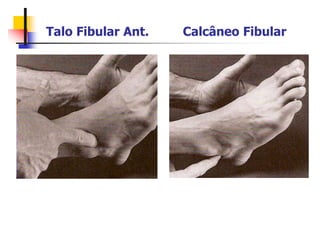 Talo Fibular Ant. Calcâneo Fibular
 