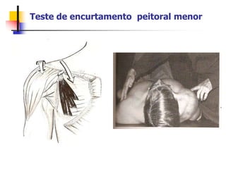 Teste de encurtamento peitoral menor
 