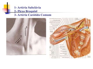 1- Artéria Subclávia
2- Plexo Braquial
3- Artéria Carótida Comum
 