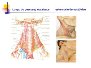 Longo do pescoço/ escalenos esternocleidomastóideo
 