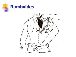 Romboídes
 