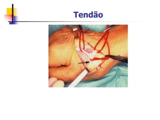Tendão
 