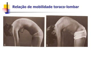 Relação de mobilidade toraco-lombar
 