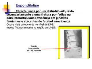 Espondilólise
Caracterizada por um distúrbio adquirido
secundariamente a uma fratura por fadiga na
pars interarticularis (evidência em ginastas
femininos e atacantes de futebol americano).
Ocorre mais comumente no nível de L5-S1;
menos frequentemente na região de L4-L5;
Porção
Interarticular
do Cão Escocês
 