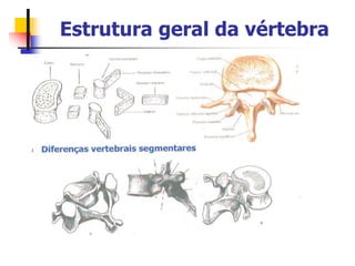 Estrutura geral da vértebra
 