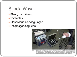 Shock Wave
 Cirurgias recentes
 Implantes
 Desordens de coagulação
 Inflamações agudas
 