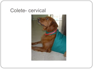 Colete- cervical
 