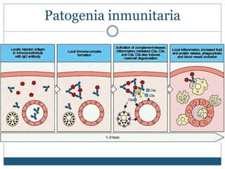 Patogenia inmunitaria