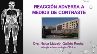 Dra. Nelva Lizbeth Guillén Rocha
Alergia e Inmunología Clínica
 