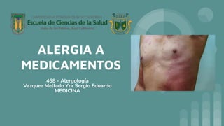 ALERGIA A
MEDICAMENTOS
468 - Alergología
Vazquez Mellado Yza Sergio Eduardo
MEDICINA
 