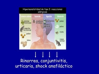 Reacciones De Hipersensibilidad