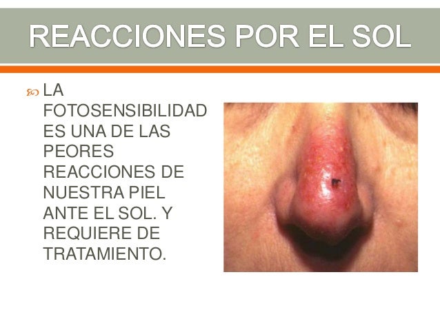 Atopichesky la dermatitis a los niños que untar