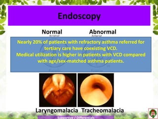 Normal Abnormal
Laryngomalacia Tracheomalacia
Endoscopy
Supportive / Differentials
Nearly 20% of patients with refractory asthma referred for
tertiary care have coexisting VCD.
Medical utilization is higher in patients with VCD compared
with age/sex-matched asthma patients.
 