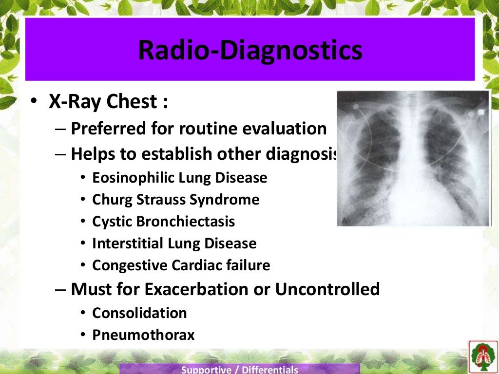 Reactive airway diseases_2018_pmm