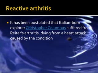    It has been postulated that Italian-born
    explorer Christopher Columbus suffered from
    Reiter's arthritis, dying from a heart attack
    caused by the condition
 