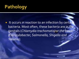     It occurs in reaction to an infection by certain
    bacteria. Most often, these bacteria are in the
    genitals (Chlamydia trachomatis) or the bowel
    (Campylobacter, Salmonella, Shigella and
    Yersinia).
 