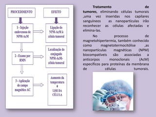 	Limpadores de pulmão	A concepção artística mostra centenas de nanorrobôs entrando em uma cavidade bronquial a caminho dos pulmões Caçador de micróbiosA ilustração mostra um nanorrobô que imita uma célula branca flutuando na corrente sanguínea a caminho de um micróbio causador de doenças. O nanorrobô irá capturá-lo e eliminá-lo.