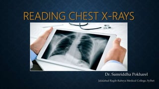 READING CHEST X-RAYS
Dr. Samriddha Pokharel
Jalalabad Ragib-Rabeya Medical College, Sylhet
 