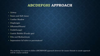ABCDEFGHI APPROACH
• Airway
• Bones and Soft tissue
• Cardiac Shadow
• Diaphragm
• Effusions(Pleura)
• Fields(Lungs)
• Gastric Bubble (Fundic gas)
• Hila and Mediastinum
• Impressions (of tubes or pacemakers)
For studying it is easier to follow ABCDEFGHI approach however for exams Outside to inside approach
will be a faster method.
 