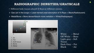 RADIOGRAPHIC DENSITIES/GRAYSCALE
• Different body tissues absorb X-Rays at different extents.
 Gas (air in the lungs) » Least dense/Least absorption of X-Rays » Black(Radiolucent)
 Metal/Bone » More dense/Absorb more radiation » White(Radiopaque)
White – Metal
Off White – Bone
Light grey – Soft
Tissue
Dark Grey – Fat
Black - Air
 