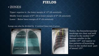 FIELDS
• ZONES
Upper: superior to the lower margin of 2nd rib anteriorly
Middle: lower margin of 2nd rib to lower margin of 4th rib anteriorly
Lower : Below lower margin of 4th rib anteriorly
Lungs can also be divided by 2 vertical lines into 3 areas .
Medial1/3rd
Middle1/3rd
Lateral1/3rd
Notice, the braonchovascular
markings are clear and well
defined in the medial 1/3rd
Become smaller in the
middle 1/3rd and appear as
fine patterns of branching
lines in the medial most part
of lateral 1/3rd .
 