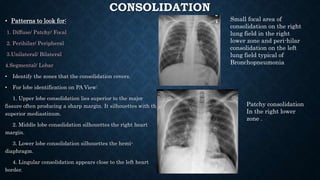 CONSOLIDATION
• Patterns to look for:
1. Diffuse/ Patchy/ Focal
2. Perihilar/ Peripheral
3.Unilateral/ Bilateral
4.Segmental/ Lobar
• Identify the zones that the consolidation covers.
• For lobe identification on PA View:
1. Upper lobe consolidation lies superior to the major
fissure often producing a sharp margin. It silhouettes with the
superior mediastinum.
2. Middle lobe consolidation silhouettes the right heart
margin.
3. Lower lobe consolidation silhouettes the hemi-
diaphragm.
4. Lingular consolidation appears close to the left heart
border.
Small focal area of
consolidation on the right
lung field in the right
lower zone and peri-hilar
consolidation on the left
lung field typical of
Bronchopneumonia
Patchy consolidation
In the right lower
zone .
 