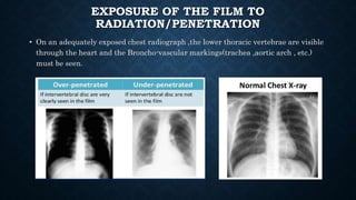 EXPOSURE OF THE FILM TO
RADIATION/PENETRATION
• On an adequately exposed chest radiograph ,the lower thoracic vertebrae are visible
through the heart and the Broncho-vascular markings(trachea ,aortic arch , etc.)
must be seen.
 