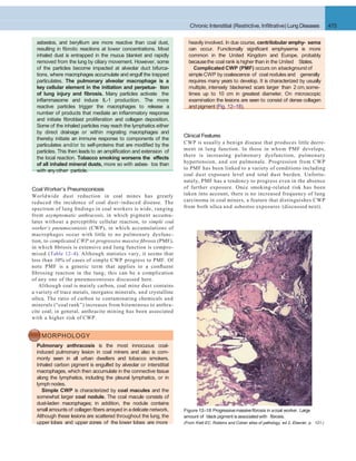 Chronic Interstitial (Restrictive, Inﬁltrative) Lung Diseases 475
Clinical Features
CWP is usually a benign disease that produces little decre-
ment in lung function. In those in whom PMF develops,
there is increasing pulmonary dysfunction, pulmonary
hypertension, and cor pulmonale. Progression from CWP
to PMF has been linked to a variety of conditions including
coal dust exposure level and total dust burden. Unfortu-
nately, PMF has a tendency to progress even in the absence
of further exposure. Once smoking-related risk has been
taken into account, there is no increased frequency of lung
carcinoma in coal miners, a feature that distinguishes CWP
from both silica and asbestos exposures (discussed next).
Coal Worker’s Pneumoconiosis
Worldwide dust reduction in coal mines has greatly
reduced the incidence of coal dust–induced disease. The
spectrum of lung ﬁndings in coal workers is wide, ranging
from asymptomatic anthracosis, in which pigment accumu-
lates without a perceptible cellular reaction, to simple coal
worker’s pneumoconiosis (CWP), in which accumulations of
macrophages occur with little to no pulmonary dysfunc-
tion, to complicated CWP or progressive massive ﬁbrosis (PMF),
in which ﬁbrosis is extensive and lung function is compro-
mised (Table 12–4). Although statistics vary, it seems that
less than 10% of cases of simple CWP progress to PMF. Of
note PMF is a generic term that applies to a conﬂuent
ﬁbrosing reaction in the lung; this can be a complication
of any one of the pneumoconioses discussed here.
Although coal is mainly carbon, coal mine dust contains
a variety of trace metals, inorganic minerals, and crystalline
silica. The ratio of carbon to contaminating chemicals and
minerals (“coal rank”) increases from bituminous to anthra-
cite coal; in general, anthracite mining has been associated
with a higher risk of CWP.
asbestos, and beryllium are more reactive than coal dust,
resulting in ﬁbrotic reactions at lower concentrations. Most
inhaled dust is entrapped in the mucus blanket and rapidly
removed from the lung by ciliary movement. However, some
of the particles become impacted at alveolar duct bifurca-
tions, where macrophages accumulate and engulf the trapped
particulates. The pulmonary alveolar macrophage is a
key cellular element in the initiation and perpetua- tion
of lung injury and ﬁbrosis. Many particles activate the
inﬂammasome and induce IL-1 production. The more
reactive particles trigger the macrophages to release a
number of products that mediate an inﬂammatory response
and initiate ﬁbroblast proliferation and collagen deposition.
Some of the inhaled particles may reach the lymphatics either
by direct drainage or within migrating macrophages and
thereby initiate an immune response to components of the
particulates and/or to self-proteins that are modiﬁed by the
particles. This then leads to an ampliﬁcation and extension of
the local reaction. Tobacco smoking worsens the effects
of all inhaled mineral dusts, more so with asbes- tos than
with anyother particle.
MORPHOLOGY
Pulmonary anthracosis is the most innocuous coal-
induced pulmonary lesion in coal miners and also is com-
monly seen in all urban dwellers and tobacco smokers.
Inhaled carbon pigment is engulfed by alveolar or interstitial
macrophages, which then accumulate in the connective tissue
along the lymphatics, including the pleural lymphatics, or in
lymph nodes.
Simple CWP is characterized by coal macules and the
somewhat larger coal nodule. The coal macule consists of
dust-laden macrophages; in addition, the nodule contains
small amounts of collagen ﬁbers arrayed in adelicate network.
Although these lesions are scattered throughout the lung, the
upper lobes and upper zones of the lower lobes are more
Figure 12–18 Progressivemassiveﬁbrosis in acoal worker. Large
amount of black pigment isassociatedwith ﬁbrosis.
(From Klatt EC: Robbins and Cotran atlas of pathology, ed 2, Elsevier, p. 121.)
heavily involved. In due course, centrilobular emphy- sema
can occur. Functionally signiﬁcant emphysema is more
common in the United Kingdom and Europe, probably
becausethe coal rank ishigher than in the United States.
Complicated CWP (PMF) occurs on abackground of
simple CWP by coalescence of coal nodules and generally
requires many years to develop. It is characterized by usually
multiple, intensely blackened scars larger than 2 cm,some-
times up to 10 cm in greatest diameter. On microscopic
examination the lesions are seen to consist of dense collagen
and pigment (Fig. 12–18).
 