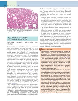 482 C H A P T E R
12
Lung
the downstream pulmonary parenchyma. Thus, occlusion
of a major vessel results in a sudden increase in pulmonary
artery pressure, diminished cardiac output, right-sided
heart failure (acute cor pulmonale), or even death. Usually
hypoxemia also develops, as a result of multiple
mechanisms:
• Perfusion of lung zones that have become atelectatic. The
alveolar collapse occurs in the ischemic areas because of
a reduction in surfactant production and because pain
associated with embolism leads to reduced movement
of the chest wall; in addition, some of the pulmonary
blood ﬂow is redirected through areas of the lung that
normally are hypoventilated.
• The decrease in cardiac output causes a widening of the
difference in arterial-venous oxygen saturation.
• Right-to-left shunting of blood may occur through a
patent foramen ovale, present in 30% of normal persons.
• If smaller vessels are occluded, the result is less cata-
strophic, and the event may even be clinically silent.
Recall that the lungs are oxygenated not only by the pul-
monary arteries but also by bronchial arteries and directly
from air in the alveoli. Thus, ischemic necrosis (infarction)
is the exception rather than the rule, occurring in as few as
10% of patients with thromboemboli. It occurs only if there
is compromise in cardiac function or bronchial circulation,
or if the region of the lung at risk is underventilated as a
result of underlying pulmonary disease.
PULMONARY DISEASES
OF VASCULAR ORIGIN
Pulmonary Embolism, Hemorrhage, and
Infarction
Blood clots that occlude the large pulmonary arteries are
almost always embolic in origin. More than 95% of all
pulmonary emboli arise from thrombi within the large
deep veins of the lower legs, typically originating in the
popliteal vein and larger veins above it. Thromboembolism
causes approximately 50,000 deaths per year in the United
States. Even when not directly fatal, it can complicate the
course of other diseases. The true incidence of nonfatal
pulmonary embolism is not known. Some cases of embo-
lism undoubtedly occur outside the hospital in ambulatory
patients, in whom the emboli are small and clinically silent.
Even among hospitalized patients, no more than one third
are diagnosed before death. Autopsy data on the incidence
of pulmonary embolism vary widely, ranging from 1% in
the general hospitalized population, to 30% in persons
dying after severe burns, trauma, or fractures.
The inﬂuences that predispose the patient to venous
thrombosis in the legs are discussed in Chapter 3, but the
following risk factors are paramount: (1) prolonged bedrest
(particularly with immobilization of the legs); (2) surgery,
especially orthopedic surgery, of knee and hip; (3) severe
trauma (including burns or multiple fractures); (4) conges-
tive heart failure; (5) in women, the period around parturi-
tion or oral contraception using birth control pills with
high estrogen content; (6) disseminated cancer; and (7)
primary disorders of hypercoagulability (e.g., factor V
Leiden) (Chapter 3).
The pathophysiologic consequences of thromboembo-
lism in the lung depend largely on the size of the embolus,
which in turn dictates the size of the occluded pulmonary
artery, and on the cardiopulmonary status of the patient.
There are two important consequences of embolic pulmo-
nary arterial occlusion: (1) an increase in pulmonary artery
pressure from blockage of ﬂow and, possibly, vasospasm
caused by neurogenic mechanisms and/or release of medi-
Figure 12–25 Desquamative interstitial pneumonia. There is accumula-
tion of large numbers of macrophages within the alveolar spaces with
only slight ﬁbrous thickening of the alveolar walls.
MORPHOLOGY
The morphologic consequences of pulmonary embolism, as
noted, depend on the size of the embolic mass and the
general state of the circulation. A large embolus may embed
in the main pulmonary artery or its major branches or lodge
astride the bifurcation as a saddle embolus (Fig. 12–26).
Death usually follows so suddenly from hypoxia or acute
failure of the right side of the heart (acute cor pulmonale)
that there is no time for morphologic alterations in the lung.
Smaller emboli become impacted in medium-sized and small
pulmonary arteries. With adequate circulation and bronchial
arterial ﬂow, the vitality of the lung parenchyma is maintained,
but alveolar hemorrhage may occur as a result of ischemic
damageto the endothelial cells.
With compromised cardiovascular status, as may occur
with congestive heart failure, infarction results. The more
peripheral the embolic occlusion, the higher the risk of infarc-
tion. About three fourths of all infarcts affect the lower lobes,
and more than half are multiple. Characteristically, they are
wedge-shaped, with their base at the pleural surface and the
apex pointing toward the hilus of the lung. Pulmonary infarcts
typically are hemorrhagic and appear asraised, red-blue areas
in the early stages (Fig. 12–27). The adjacent pleural surface
often is covered by a ﬁbrinous exudate. If the occluded vessel
can be identiﬁed, it usually is found near the apex of the
infarcted area. The red cells begin to lyse within 48 hours,
and the infarct pales, eventually becoming red-brown as
hemosiderin is produced. In time, ﬁbrous replacement begins
at the margins as a gray-white peripheral zone and eventually
converts the infarct into a scar. On histologic examination,
the hallmark of fresh infarcts is coagulative necrosis ofthelungparenchyma and hemorrhage.
ators (e.g., thromboxane A2, serotonin); and (2) ischemia of
 