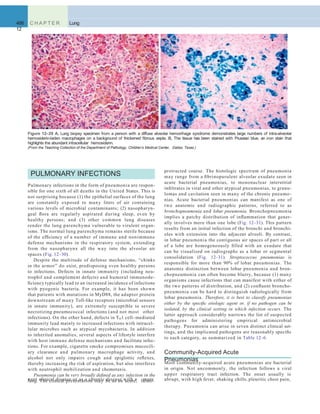 486 C H A P T E R
12
Lung
protracted course. The histologic spectrum of pneumonia
may range from a ﬁbrinopurulent alveolar exudate seen in
acute bacterial pneumonias, to mononuclear interstitial
inﬁltrates in viral and other atypical pneumonias, to granu-
lomas and cavitation seen in many of the chronic pneumo-
nias. Acute bacterial pneumonias can manifest as one of
two anatomic and radiographic patterns, referred to as
bronchopneumonia and lobar pneumonia. Bronchopneumonia
implies a patchy distribution of inﬂammation that gener-
ally involves more than one lobe (Fig. 12–31). This pattern
results from an initial infection of the bronchi and bronchi-
oles with extension into the adjacent alveoli. By contrast,
in lobar pneumonia the contiguous air spaces of part or all
of a lobe are homogeneously ﬁlled with an exudate that
can be visualized on radiographs as a lobar or segmental
consolidation (Fig. 12–31). Streptococcus pneumoniae is
responsible for more than 90% of lobar pneumonias. The
anatomic distinction between lobar pneumonia and bron-
chopneumonia can often become blurry, because (1) many
organisms cause infections that can manifest with either of
the two patterns of distribution, and (2) conﬂuent broncho-
pneumonia can be hard to distinguish radiologically from
lobar pneumonia. Therefore, it is best to classify pneumonias
either by the speciﬁc etiologic agent or, if no pathogen can be
isolated, by the clinical setting in which infection occurs. The
latter approach considerably narrows the list of suspected
pathogens for administering empirical antimicrobial
therapy. Pneumonia can arise in seven distinct clinical set-
tings, and the implicated pathogens are reasonably speciﬁc
to each category, as summarized in Table 12–6.
Community-Acquired Acute
PneumoniasMost community-acquired acute pneumonias are bacterial
in origin. Not uncommonly, the infection follows a viral
upper respiratory tract infection. The onset usually is
PULMONARY INFECTIONS
Pulmonary infections in the form of pneumonia are respon-
sible for one sixth of all deaths in the United States. This is
not surprising because (1) the epithelial surfaces of the lung
are constantly exposed to many liters of air containing
various levels of microbial contaminants; (2) nasopharyn-
geal ﬂora are regularly aspirated during sleep, even by
healthy persons; and (3) other common lung diseases
render the lung parenchyma vulnerable to virulent organ-
isms. The normal lung parenchyma remains sterile because
of the efﬁciency of a number of immune and nonimmune
defense mechanisms in the respiratory system, extending
from the nasopharynx all the way into the alveolar air
spaces (Fig. 12–30).
Despite the multitude of defense mechanisms, “chinks
in the armor” do exist, predisposing even healthy persons
to infections. Defects in innate immunity (including neu-
trophil and complement defects) and humoral immunode-
ﬁciency typically lead to an increased incidence of infections
with pyogenic bacteria. For example, it has been shown
that patients with mutations in MyD88, the adaptor protein
downstream of many Toll-like receptors (microbial sensors
in innate immunity), are extremely susceptible to severe
necrotizing pneumococcal infections (and not most other
infections). On the other hand, defects in TH1 cell–mediated
immunity lead mainly to increased infections with intracel-
lular microbes such as atypical mycobacteria. In addition
to inherited anomalies, several aspects of lifestyle interfere
with host immune defense mechanisms and facilitate infec-
tions. For example, cigarette smoke compromises mucocili-
ary clearance and pulmonary macrophage activity, and
alcohol not only impairs cough and epiglottic reﬂexes,
thereby increasing the risk of aspiration, but also interferes
with neutrophil mobilization and chemotaxis.
Pneumonia can be very broadly deﬁned as any infection in the
lung. The clinical presentation may be as an acute, fulmi-
A B
Figure 12–29 A, Lung biopsy specimen from a person with a diffuse alveolar hemorrhage syndrome demonstrates large numbers of intra-alveolar
hemosiderin-laden macrophages on a background of thickened ﬁbrous septa. B, The tissue has been stained with Prussian blue, an iron stain that
highlights the abundant intracellular hemosiderin.
(From the Teaching Collection of the Department of Pathology, Children’s Medical Center, Dallas, Texas.)
nant clinical disease or as a chronic disease with a more abrupt, with high fever, shaking chills, pleuritic chest pain,
 