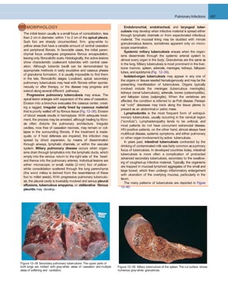 Pulmonary Infections 497
Figure 12–38 Secondary pulmonary tuberculosis. The upper parts of
both lungs are riddled with gray-white areas of caseation and multiple Figure 12–39 Miliary tuberculosis of the spleen. The cut surface shows
MORPHOLOGY
The initial lesion usually is a small focus of consolidation, less
than 2 cm in diameter, within 1 to 2 cm of the apical pleura.
Such foci are sharply circumscribed, ﬁrm, gray-white to
yellow areas that have a variable amount of central caseation
and peripheral ﬁbrosis. In favorable cases, the initial paren-
chymal focus undergoes progressive ﬁbrous encapsulation,
leaving only ﬁbrocalciﬁc scars. Histologically, the active lesions
show characteristic coalescent tubercles with central case-
ation. Although tubercle bacilli can be demonstrated by
appropriate methods in early exudative and caseous phases
of granuloma formation, it is usually impossible to ﬁnd them
in the late, ﬁbrocalciﬁc stages. Localized, apical, secondary
pulmonary tuberculosis may heal with ﬁbrosis either sponta-
neously or after therapy, or the disease may progress and
extend alongseveral different pathways.
Progressive pulmonary tuberculosis may ensue. The
apical lesion enlarges with expansion of the area of caseation.
Erosion into a bronchus evacuates the caseous center, creat-
ing a ragged, irregular cavity lined by caseous material
that is poorly walled off by ﬁbrous tissue (Fig. 12–38). Erosion
of blood vessels results in hemoptysis. With adequate treat-
ment, the process may be arrested, although healing by ﬁbro-
sis often distorts the pulmonary architecture. Irregular
cavities, now free of caseation necrosis, may remain or col-
lapse in the surrounding ﬁbrosis. If the treatment is inade-
quate, or if host defenses are impaired, the infection may
spread by direct expansion, by means of dissemination
through airways, lymphatic channels, or within the vascular
system. Miliary pulmonary disease occurs when organ-
isms drain through lymphatics into the lymphatic ducts, which
empty into the venous return to the right side of the heart
and thence into the pulmonary arteries. Individual lesions are
either microscopic or small, visible (2 mm) foci of yellow-
white consolidation scattered through the lung parenchyma
(the word miliary is derived from the resemblance of these
foci to millet seeds). With progressive pulmonary tuberculo-
sis, the pleural cavity is invariably involved and serous pleural
effusions, tuberculous empyema, or obliterative ﬁbrous
pleuritis may develop.
Endobronchial, endotracheal, and laryngeal tuber-
culosis may develop when infective material is spread either
through lymphatic channels or from expectorated infectious
material. The mucosal lining may be studded with minute
granulomatous lesions, sometimes apparent only on micro-
scopic examination.
Systemic miliary tuberculosis ensues when the organ-
isms disseminate through the systemic arterial system to
almost every organ in the body. Granulomas are the same as
in the lung. Miliary tuberculosis is most prominent in the liver,
bone marrow, spleen, adrenals, meninges, kidneys, fallopian
tubes, and epididymis (Fig. 12–39).
Isolated-organ tuberculosis may appear in any one of
the organs or tissues seeded hematogenously and may be the
presenting manifestation of tuberculosis. Organs typically
involved include the meninges (tuberculous meningitis),
kidneys (renal tuberculosis), adrenals, bones (osteomyelitis),
and fallopian tubes (salpingitis). When the vertebrae are
affected, the condition is referred to as Pott disease. Paraspi-
nal “cold” abscesses may track along the tissue planes to
present as an abdominal or pelvic mass.
Lymphadenitis is the most frequent form of extrapul-
monary tuberculosis, usually occurring in the cervical region
(“scrofula”). Lymphadenopathy tends to be unifocal, and
most patients do not have concurrent extranodal disease.
HIV-positive patients, on the other hand, almost always have
multifocal disease, systemic symptoms, and either pulmonary
or other organ involvement by active tuberculosis.
In years past, intestinal tuberculosis contracted by the
drinking of contaminated milk was fairly common asaprimary
focus of tuberculosis. In developed countries today, intestinal
tuberculosis is more often a complication of protracted
advanced secondary tuberculosis, secondary to the swallow-
ing of coughed-up infective material. Typically, the organisms
are trapped in mucosal lymphoid aggregates of the small and
large bowel, which then undergo inﬂammatory enlargement
with ulceration of the overlying mucosa, particularly in the
ileum.
The many patterns of tuberculosis are depicted in Figure
12–40.
areas of softening and cavitation. numerous gray-white granulomas.
 